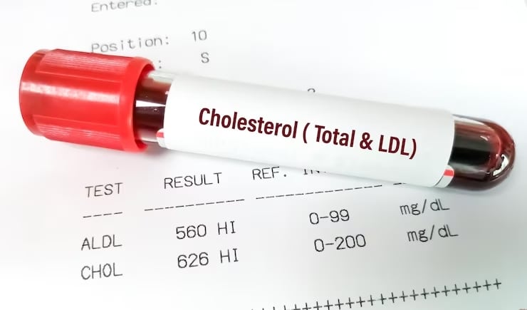 Cholesterol text tube