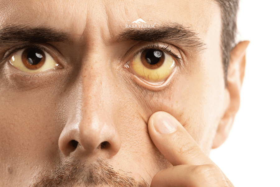 Eye health, curcumin supplement